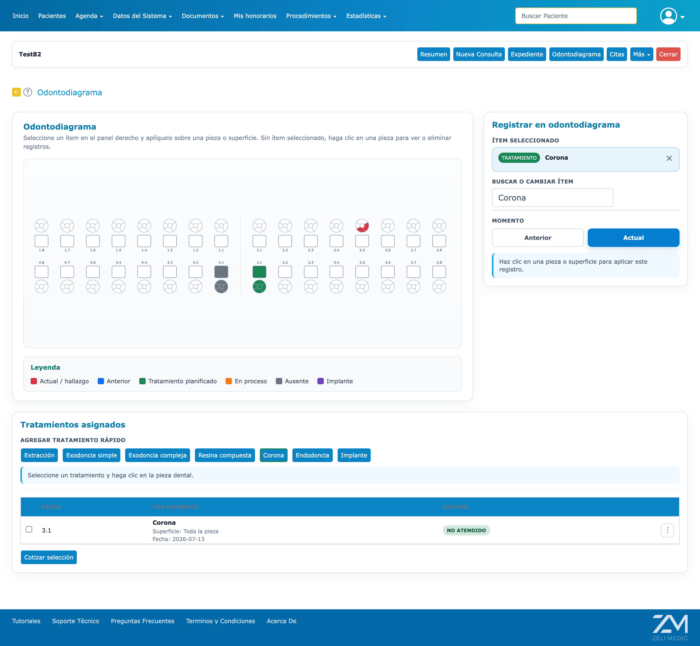 Captura de Zeli Medic: Odontodiagrama interactivo por pieza dental para Odontología